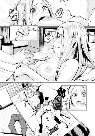 Cryptococcosis | 隐球菌病